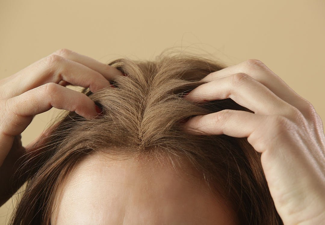 Dry scalp